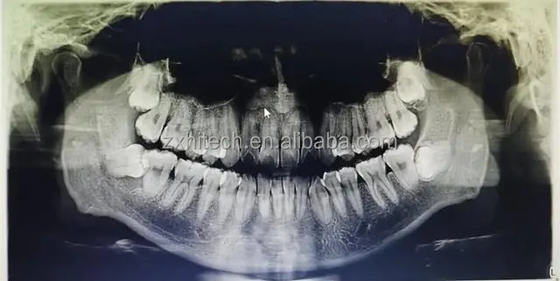 CT dental 3D CBCT Equipo digital de rayos X China